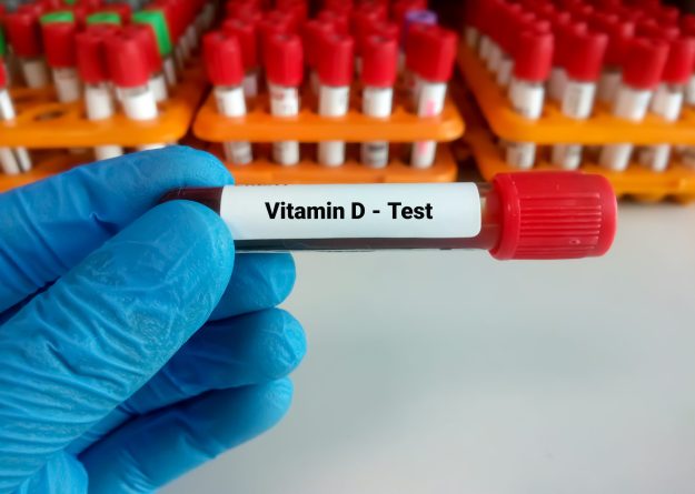 Blood,Sample,For,Vitamin,D,Test,With,Laboratory,Background.,Close
