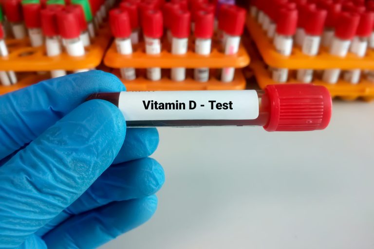 Blood,Sample,For,Vitamin,D,Test,With,Laboratory,Background.,Close